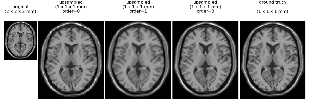 An example interpolation, using scipy.ndimage.zoom. The example shows five different synthetic brain MRIs. Each MRI has a different interpolation method.